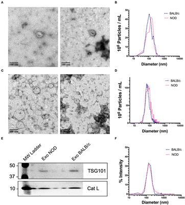 Small RNA Deep Sequencing Identifies a Unique miRNA Signature Released in Serum Exosomes in a Mouse Model of Sjögren's Syndrome